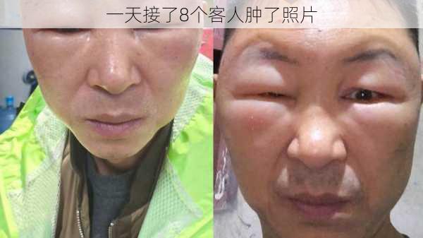 一天接了8个客人肿了照片