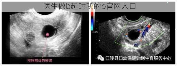 医生做b超时我的b官网入口