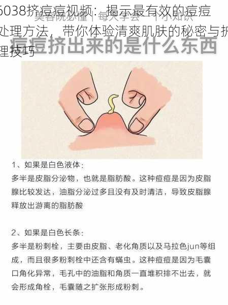 6038挤痘痘视频：揭示最有效的痘痘处理方法，带你体验清爽肌肤的秘密与护理技巧